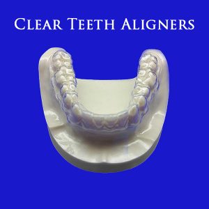 Cheap Invisible Aligners Online