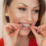 invisible teeth aligners cheap