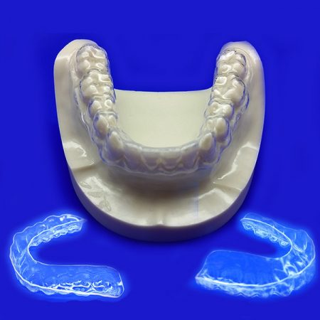 Invisible Aligners Cheap