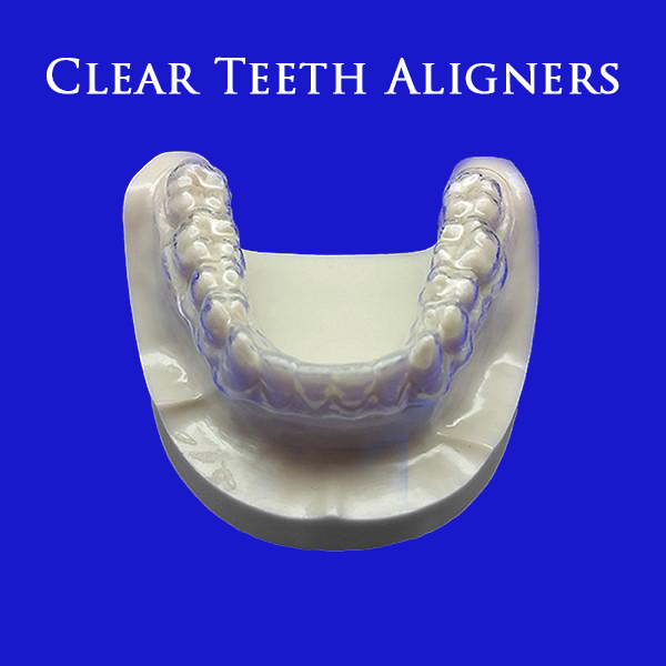Cheap Invisible Aligners Online