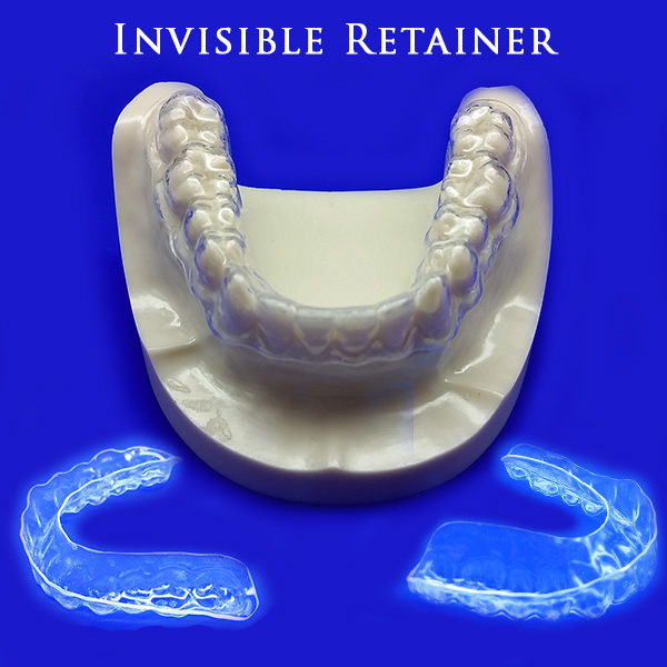 Invisible Retainer Cost