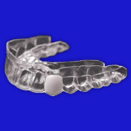 Temp Teeth